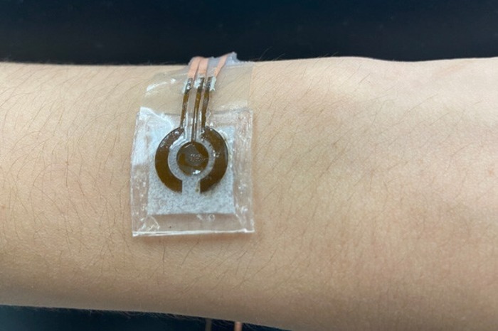 New wearable device uses sweat to monitor glucose levels