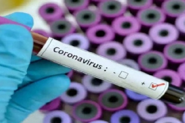 Mysuru on alert as 72 nursing students test positive for Covid-19