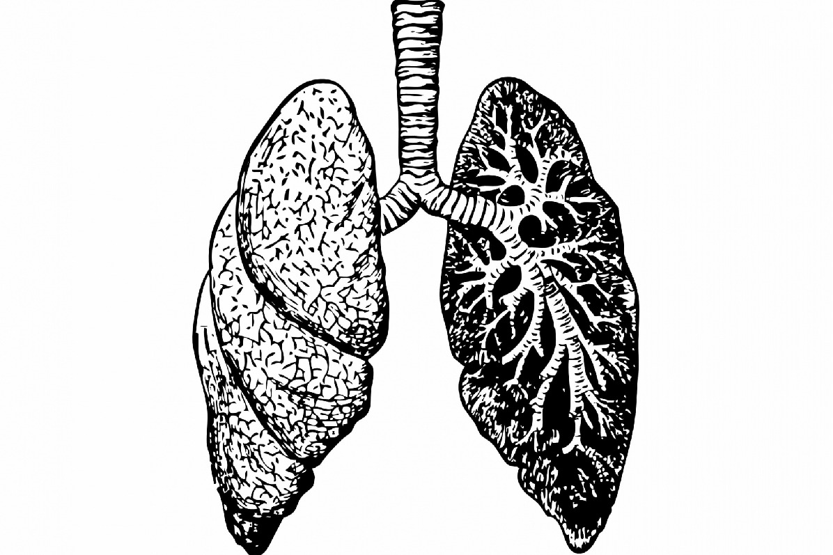 A malaria drug may protect lung cells against Covid