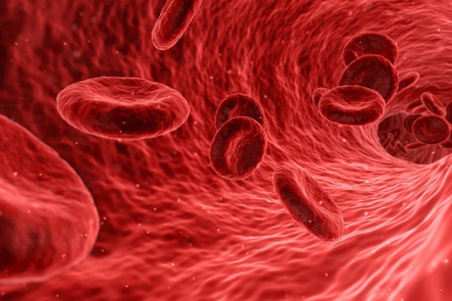 Scientists pinpoint mechanisms linked with severe Covid blood clotting