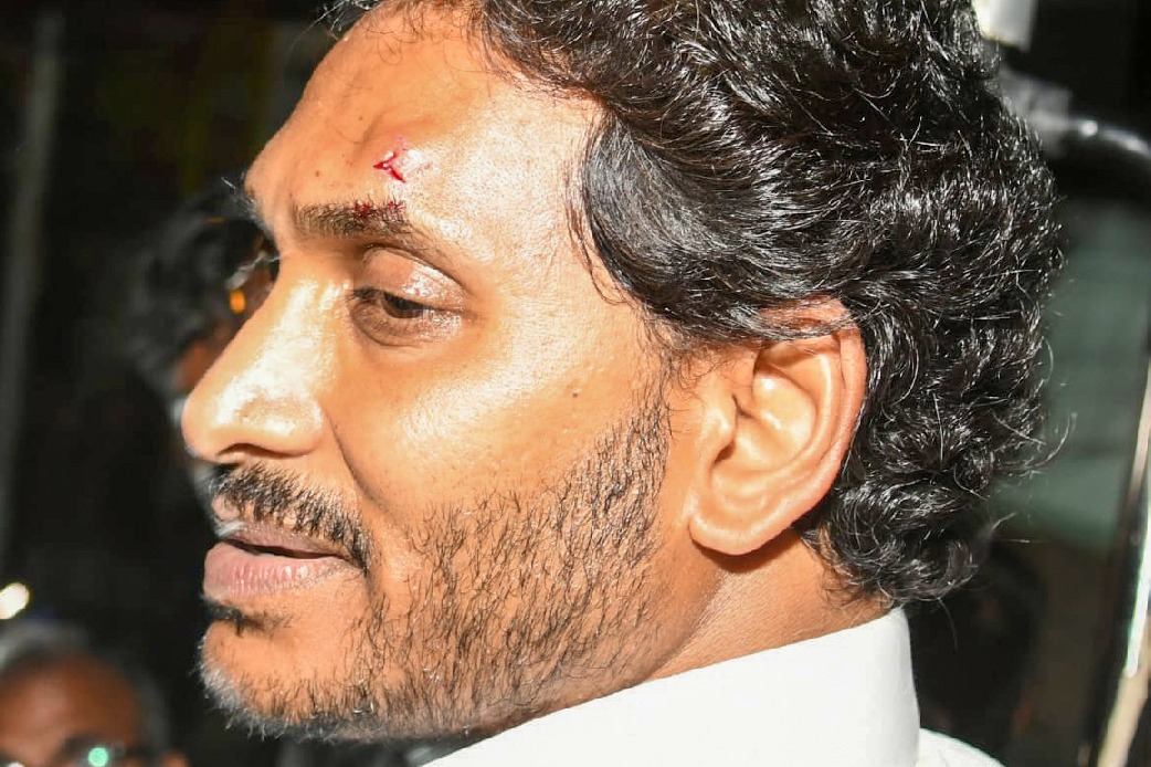 YSR Congress blames TDP for attack on Jagan