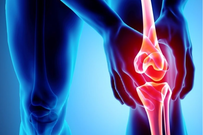 Early detection of 'osteoarthritis' may allow therapy that improves joint health: Researchers