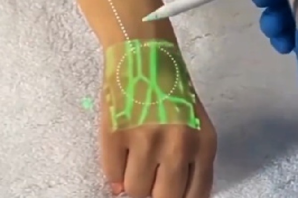 Anand Mahindra shares video of new tech detecting veins using infrared light