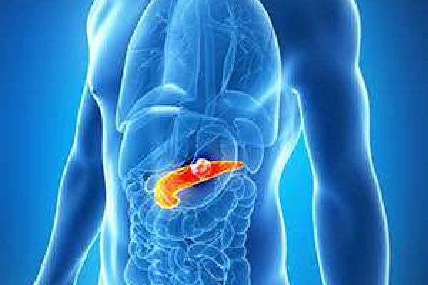 Pancreatic cancer patients may benefit from a ketogenic diet