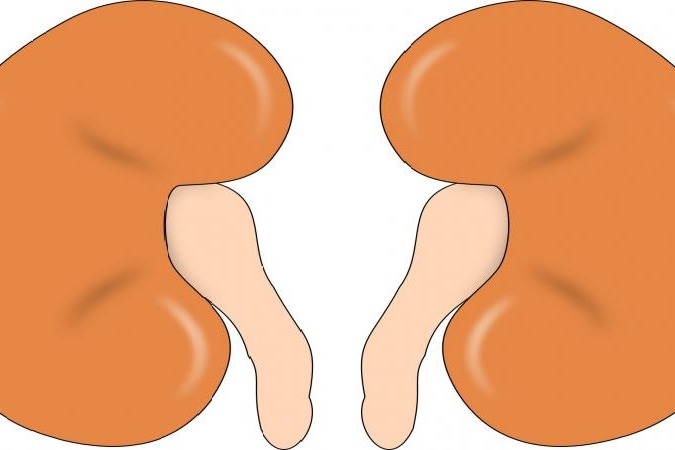 Study shows dialysis not a feasible option for all elderly with kidney failure