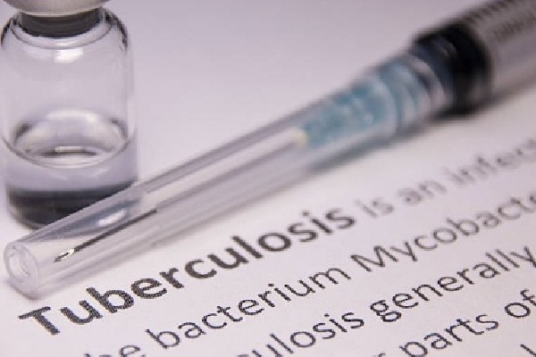 Study explains why treatments for autoimmune, inflammatory diseases raise TB risk