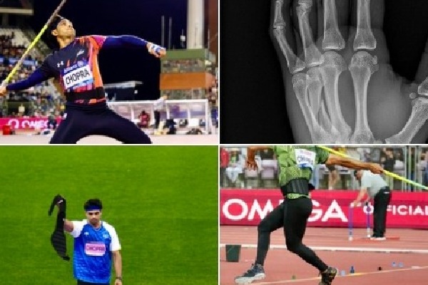 Neeraj Chopra competed in the Diamond League Final with fractured left hand