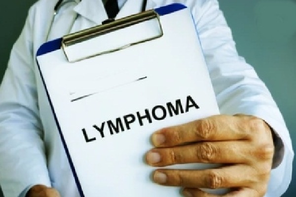 CAR-T cell therapy, bone marrow transplant boosting Lymphoma outcomes: Experts