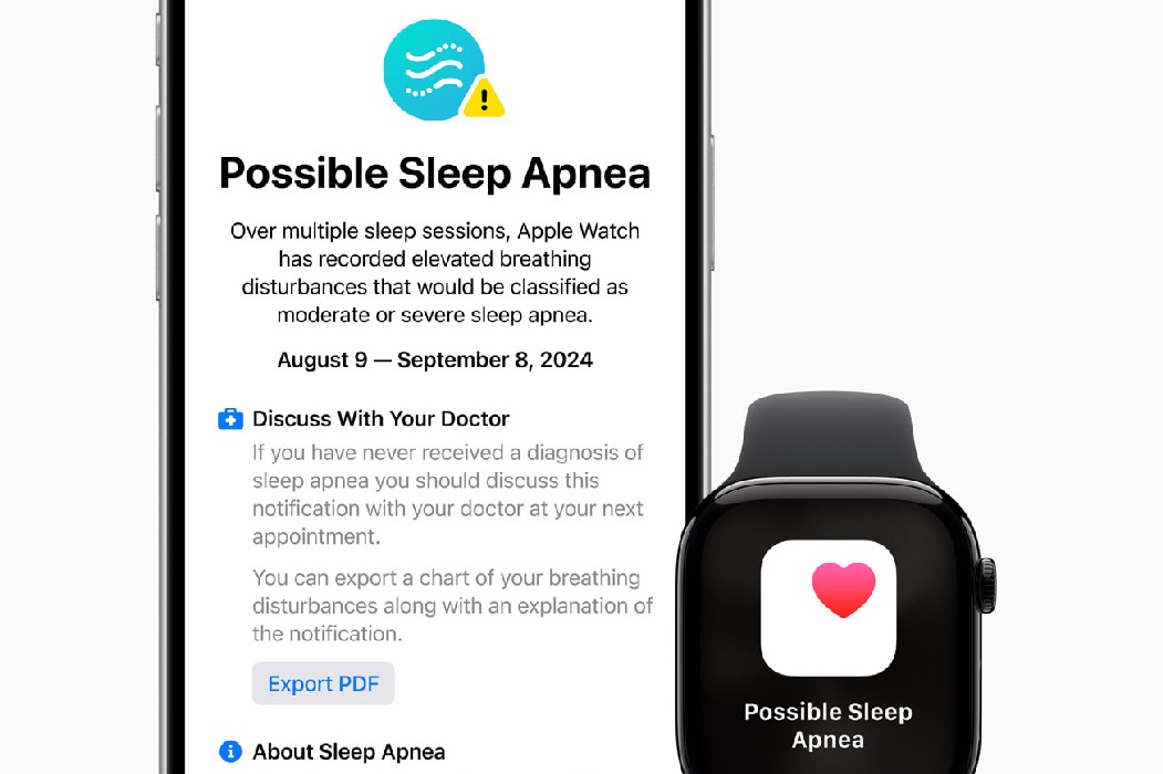 Sleep apnoea alert feature on Apple Watch gets US FDA approval