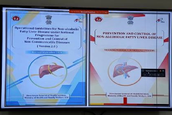 Union Health Ministry releases new guidelines for non-alcoholic fatty liver disease