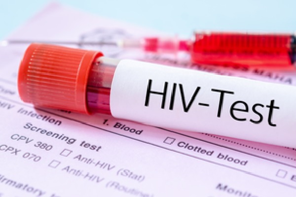 AIDS Society of India urges government to include HIV self-testing in policies