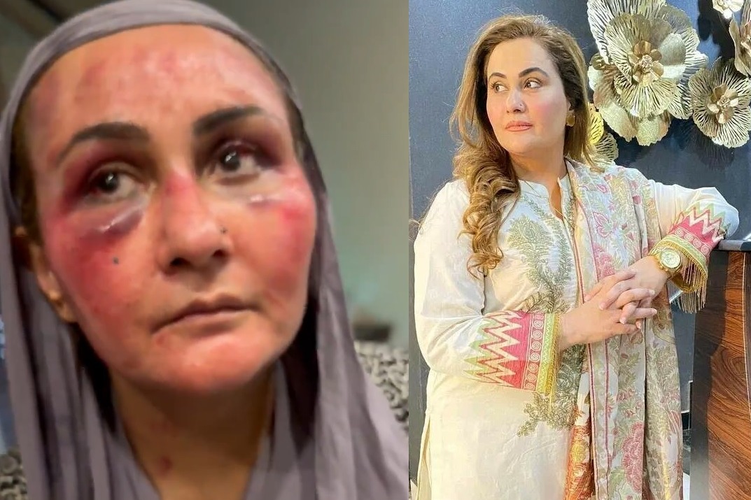 Hit with gun and dragged by hair, Pakistani actress reveals brutal torture