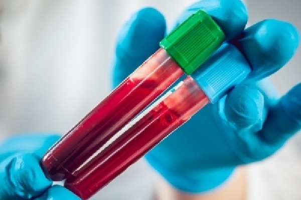 Blood-biomarker tests may aid in early diagnosis of Alzheimer’s: Report