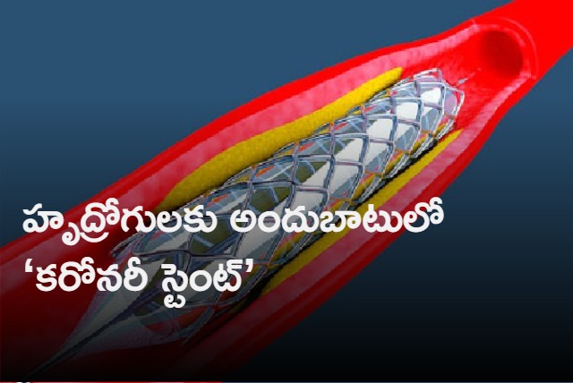 Coronary Stent Is Now In Essential Medicine List