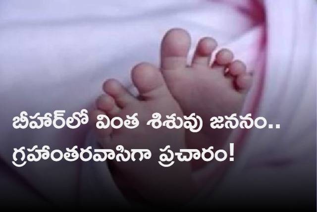 Infant born with rare deformity in Bihars