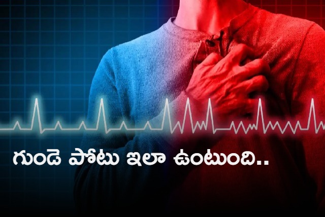 What does a heart attack feel like Survivors share c key points to know