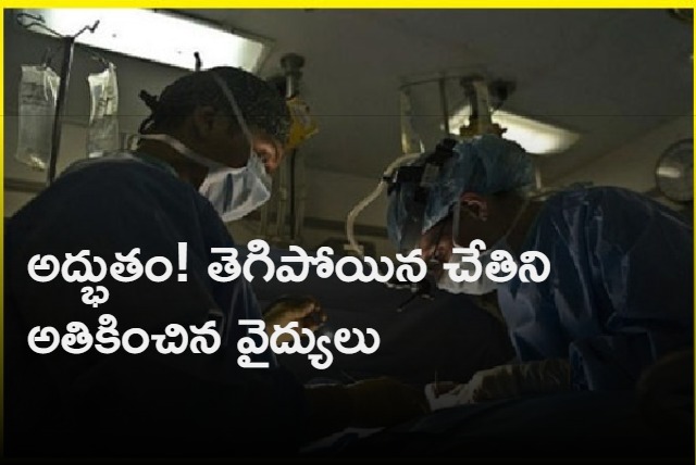 Severed wrist successfully restored at Bengaluru hospital