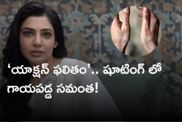 Samantha Ruth Prabhu get injured on Citadel sets