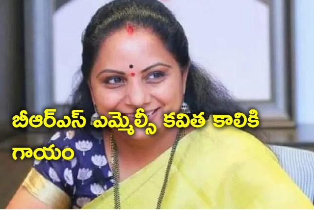 MLC Kavitha Got Avulsion Fractures Rest for 3 Weeks as Doctors Suggest