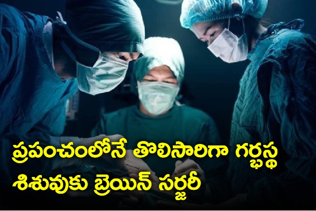 American doctors perform worlds first brain surgery on foetus