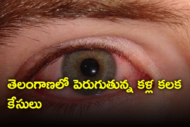 Conjunctivitis cases rising in telangana