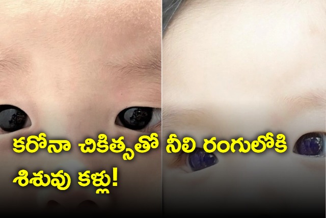 Babys Dark Brown Eyes Turn Blue After Covid 19 Treatment In Thailand