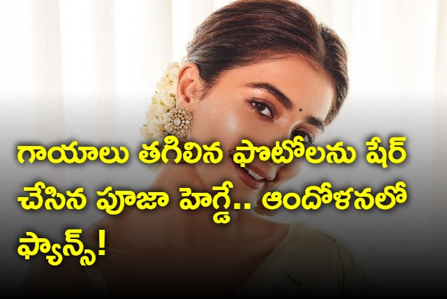 Pooja Hegde posted skin scar pics