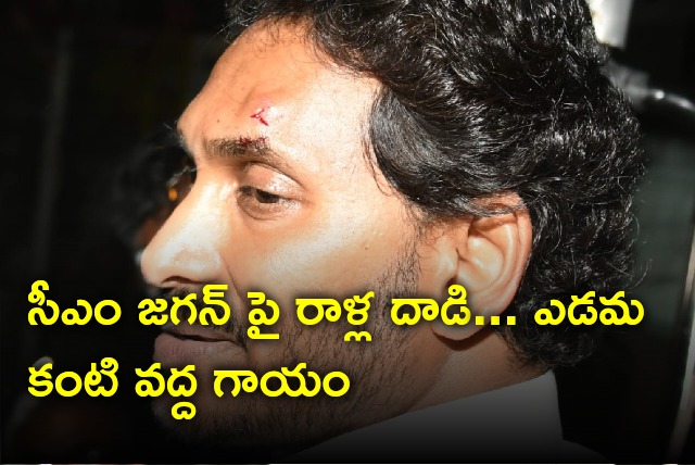 CM Jagan injured in stone pelting