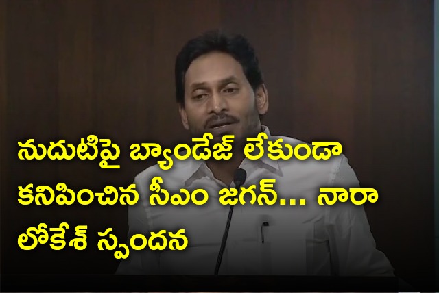 Nara Lokesh responds on CM Jagan seen without bandage 