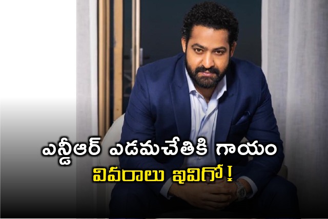 NTR injured in Gym while doing workouts 